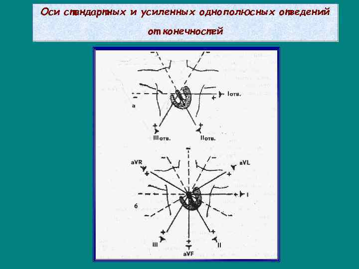 Оси стандартных и усиленных однополюсных отведений от конечностей 