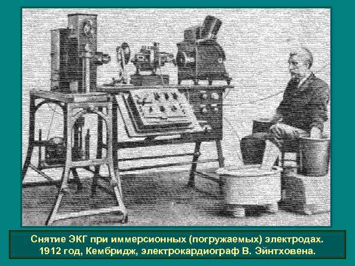 Снятие ЭКГ при иммерсионных (погружаемых) электродах. 1912 год, Кембридж, электрокардиограф В. Эйнтховена. 
