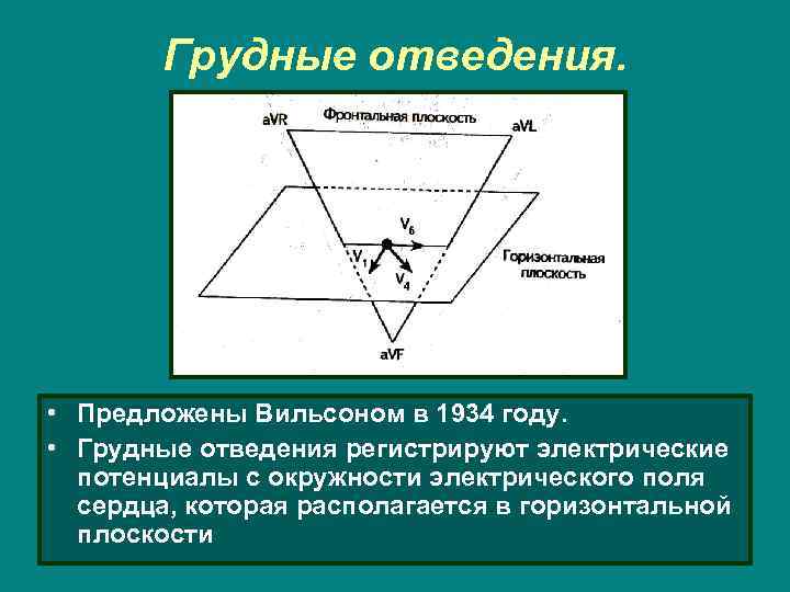 Грудные отведения. • Предложены Вильсоном в 1934 году. • Грудные отведения регистрируют электрические потенциалы
