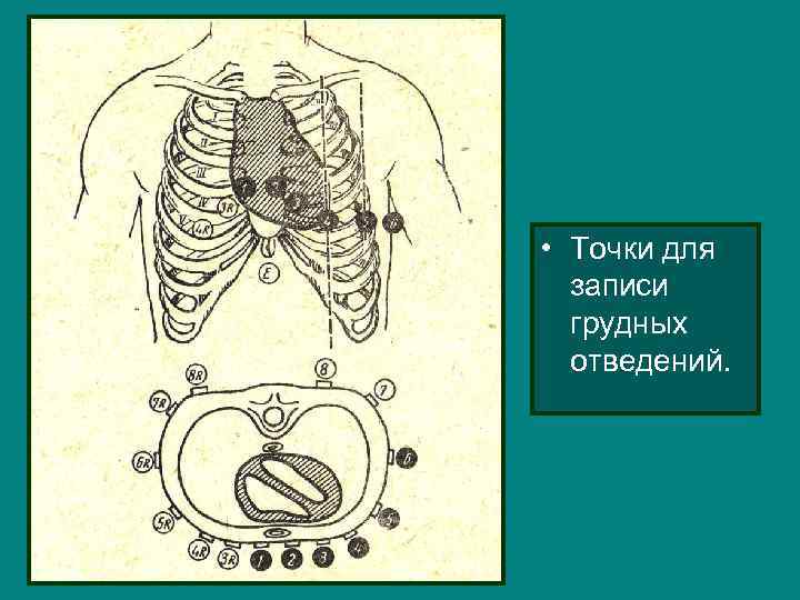  • Точки для записи грудных отведений. 