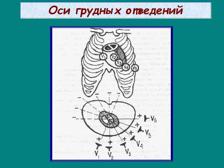 Оси грудных отведений 
