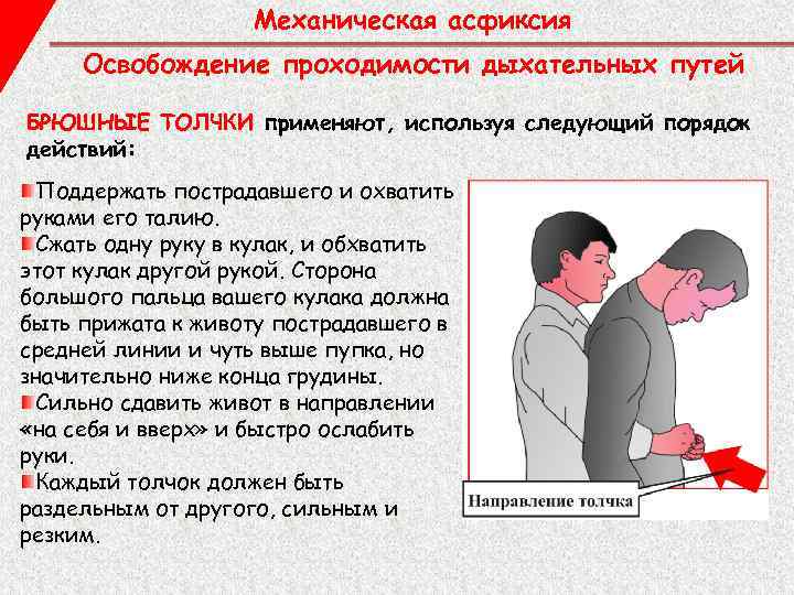 Механическая асфиксия Освобождение проходимости дыхательных путей БРЮШНЫЕ ТОЛЧКИ применяют, используя следующий порядок действий: Поддержать