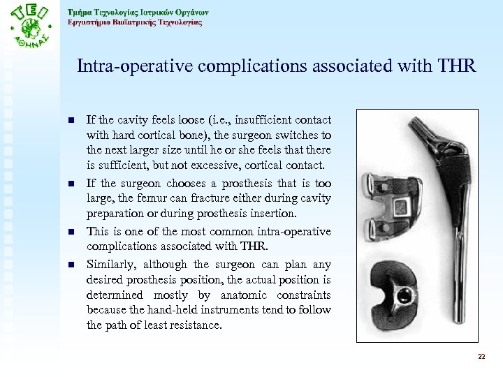 Intra-operative complications associated with THR n n If the cavity feels loose (i. e.