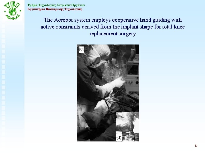The Acrobot system employs cooperative hand guiding with active constraints derived from the implant