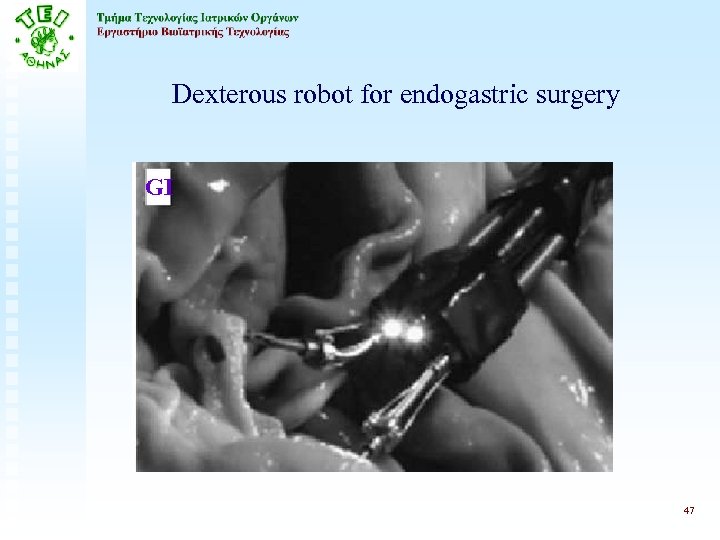 Dexterous robot for endogastric surgery GI 47 