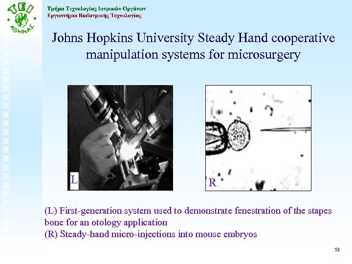 Johns Hopkins University Steady Hand cooperative manipulation systems for microsurgery L R (L) First-generation