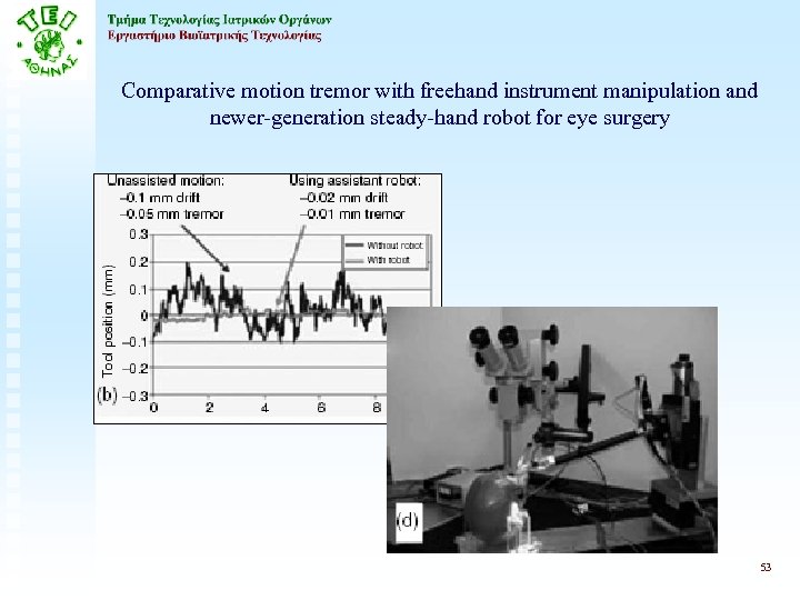 Comparative motion tremor with freehand instrument manipulation and newer-generation steady-hand robot for eye surgery