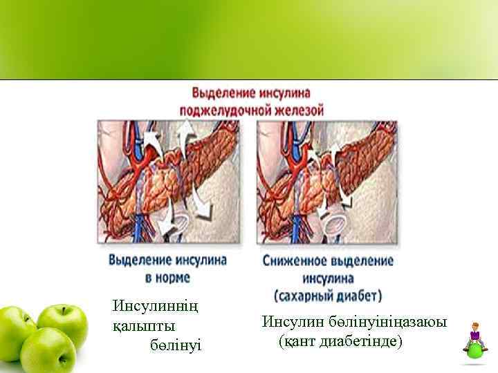 Инсулиннің қалыпты бөлінуі Инсулин бөлінуініңазаюы (қант диабетінде) 