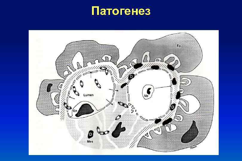 Патогенез 2010 