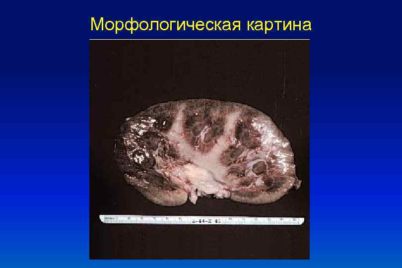 Морфологическая картина 