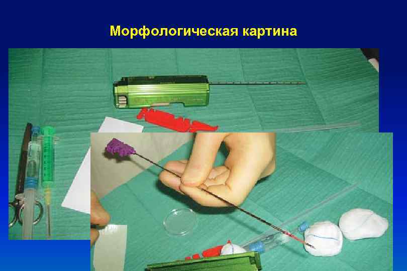 Морфологическая картина 