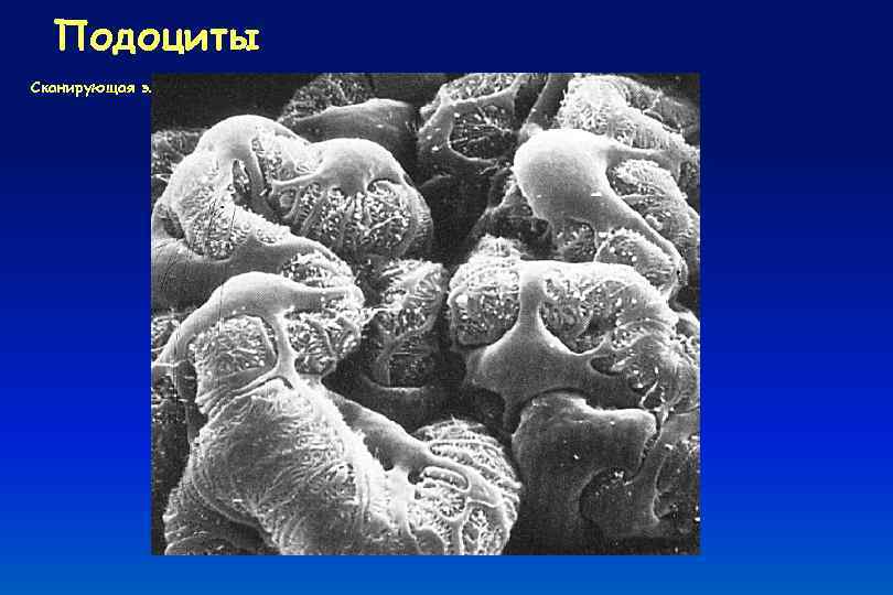 Подоциты Сканирующая электроннограмма 