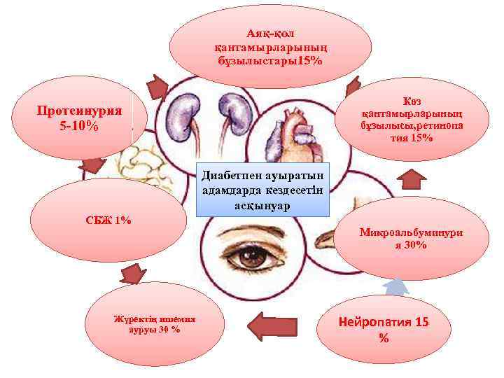 Аяқ-қол қантамырларының бұзылыстары15% Көз қантамырларының бұзылысы, ретинопа тия 15% Протеинурия 5 -10% Диабетпен ауыратын