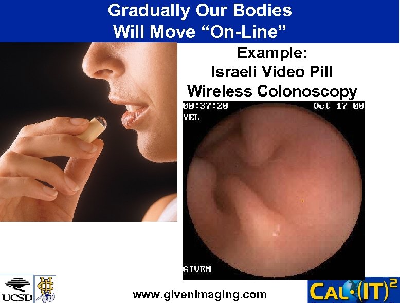 Gradually Our Bodies Will Move “On-Line” Example: Israeli Video Pill Wireless Colonoscopy www. givenimaging.