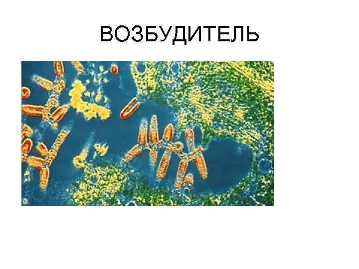 ВОЗБУДИТЕЛЬ 