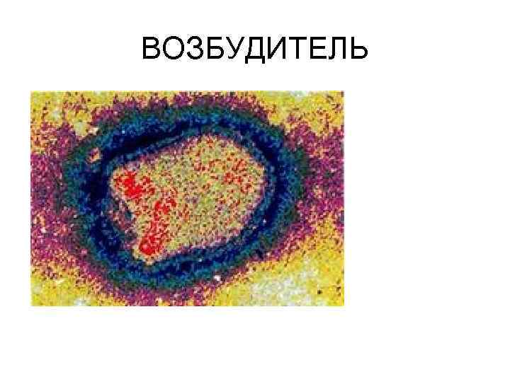 ВОЗБУДИТЕЛЬ 