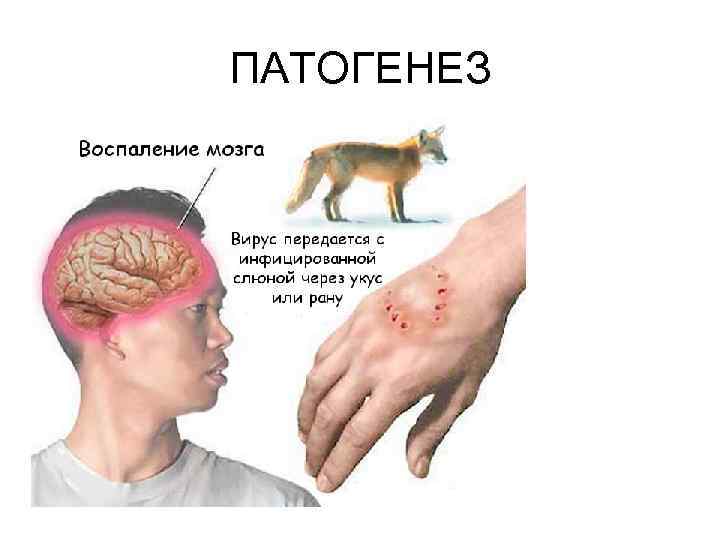 ПАТОГЕНЕЗ 