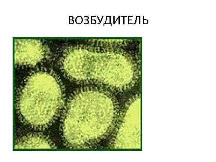 Презентация болезнь ньюкасла