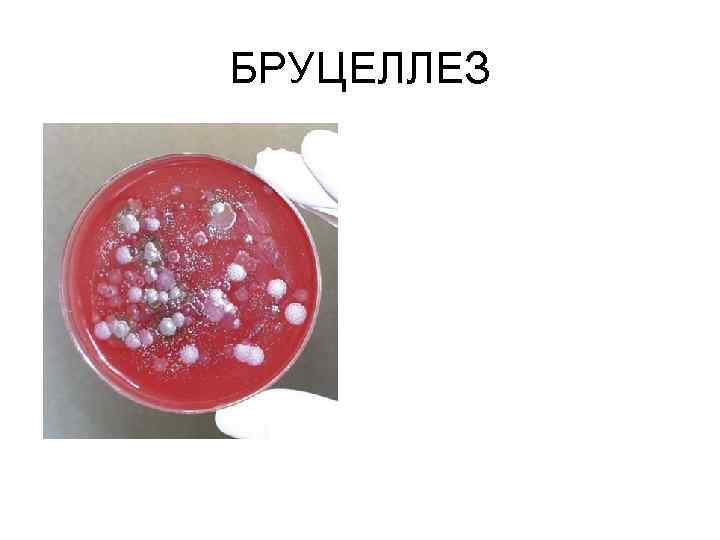 БРУЦЕЛЛЕЗ 