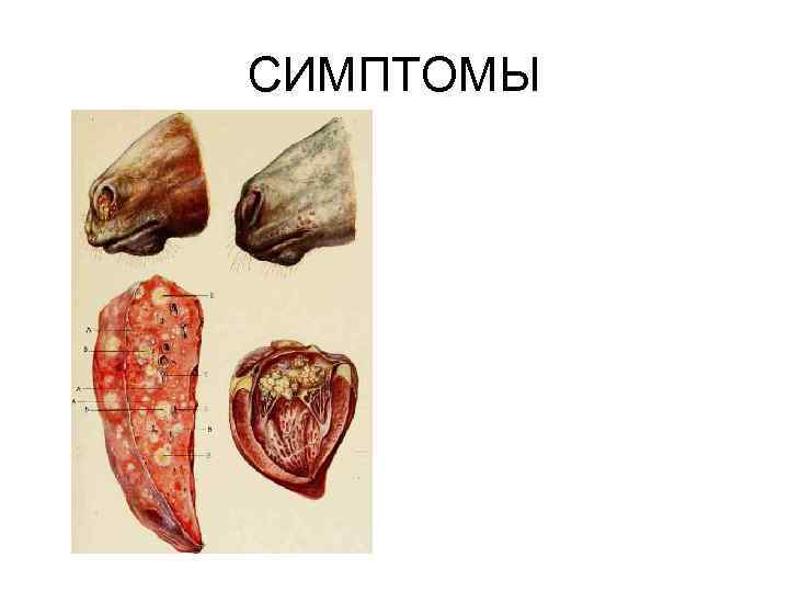 СИМПТОМЫ 