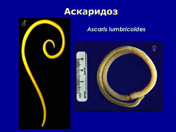 Аскаридоз ♂ Ascaris lumbricoides ♀ 
