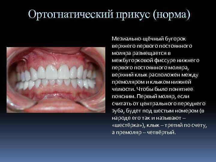 Ортогнатический прикус (норма) Мезиально-щёчный бугорок верхнего первого постоянного моляра размещается в межбугорковой фиссуре нижнего