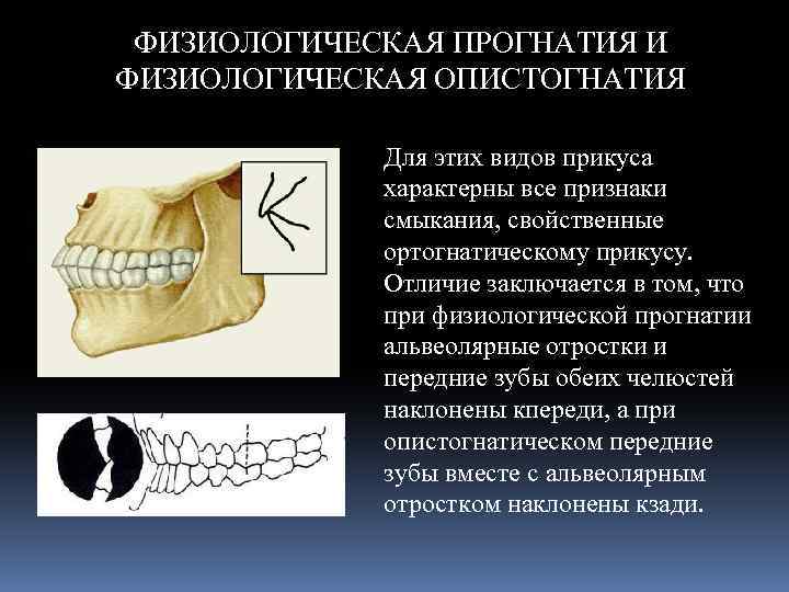 Виды прикусов презентация