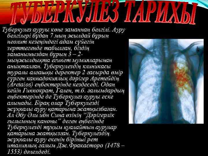 Туберкулез ауруы көне заманнан белгілі. Ауру белгілері бұдан 7 мың жылдай бұрын неолит кезеңіндегі