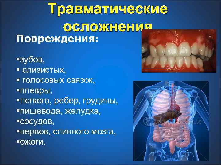Травматические осложнения Повреждения: §зубов, § слизистых, § голосовых связок, §плевры, §легкого, ребер, грудины, §пищевода,