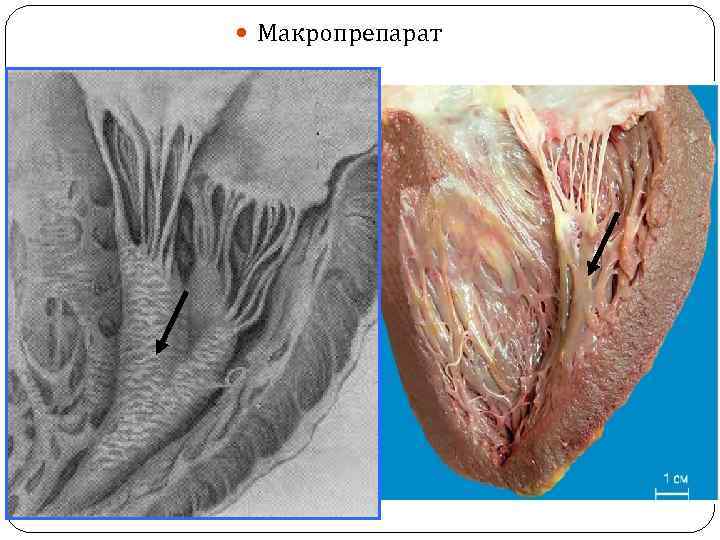  Макропрепарат 