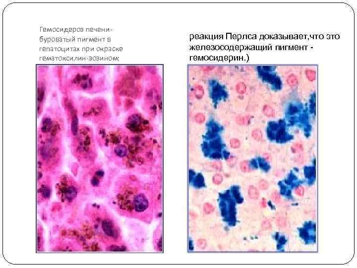 Реакция перлса