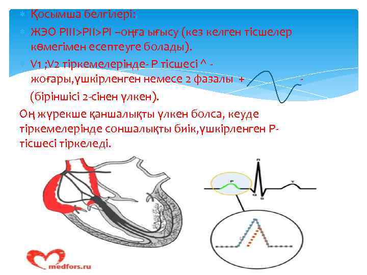  Қосымша белгілері: ЖЭО РІІІ>РІ –оңға ығысу (кез келген тісшелер көмегімен есептеуге болады). V
