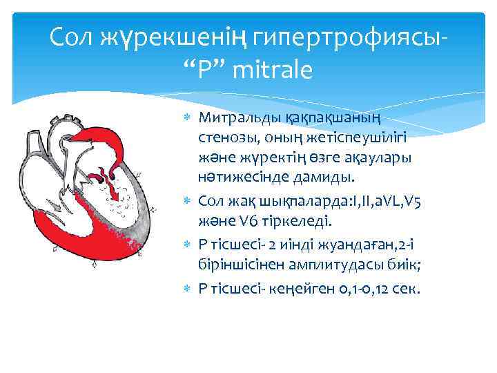 Сол жүрекшенің гипертрофиясы“P” mitrale Митральды қақпақшаның стенозы, оның жетіспеушілігі және жүректің өзге ақаулары нәтижесінде