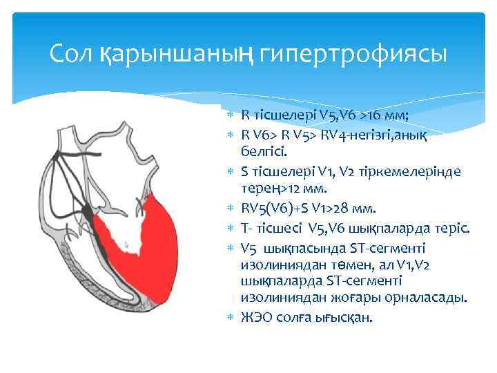 Сол қарыншаның гипертрофиясы R тісшелері V 5, V 6 >16 мм; R V 6>