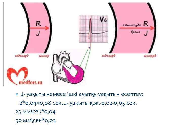  J- уақыты немесе ішкі ауытқу уақытын есептеу: 2*0, 04=0, 08 сек. J- уақыты