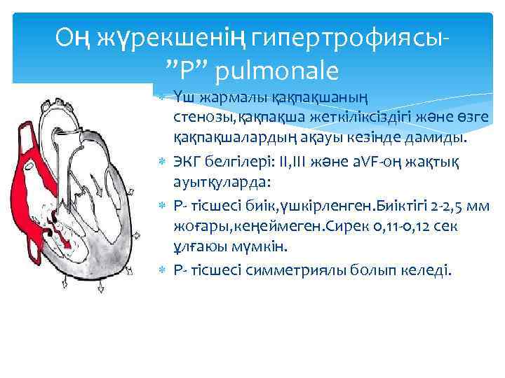 Оң жүрекшенің гипертрофиясы”P” pulmonale Үш жармалы қақпақшаның стенозы, қақпақша жеткіліксіздігі және өзге қақпақшалардың ақауы