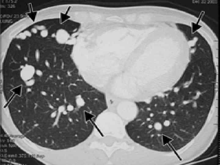 Dr. A. Solomonov. Pulmonology 