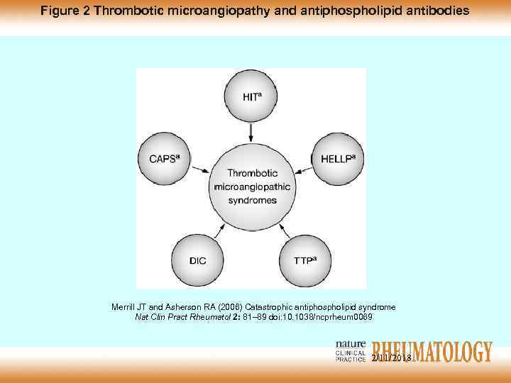 Figure 2 Thrombotic microangiopathy and antiphospholipid antibodies Merrill JT and Asherson RA (2006) Catastrophic