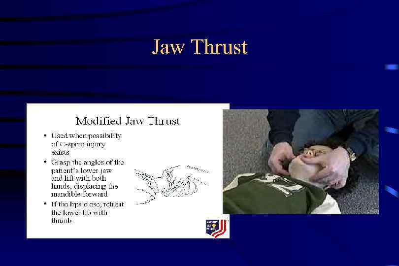 Jaw Thrust 