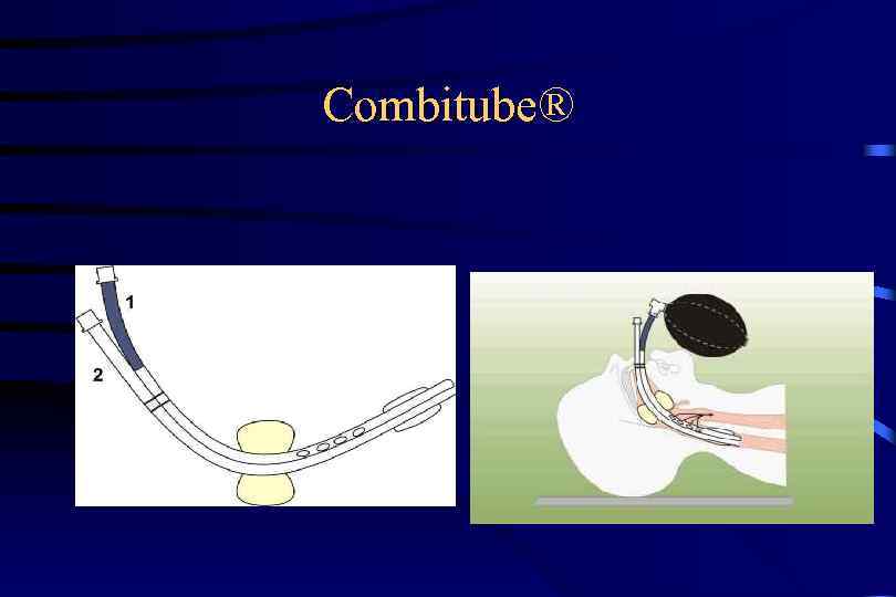 Combitube® 