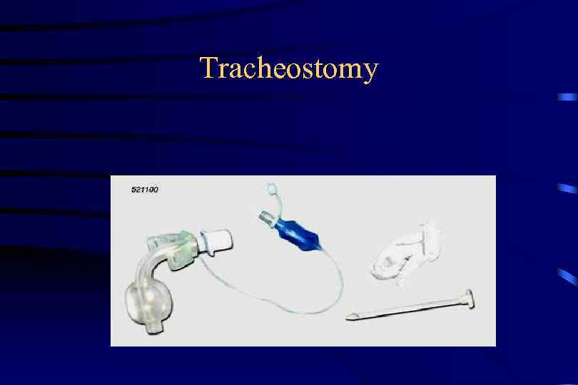 Tracheostomy 