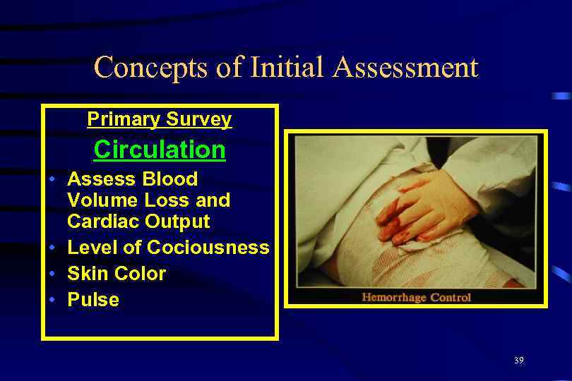 Concepts of Initial Assessment Primary Survey Circulation • Assess Blood Volume Loss and Cardiac