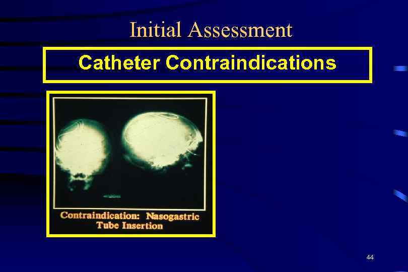 Initial Assessment Catheter Contraindications 44 