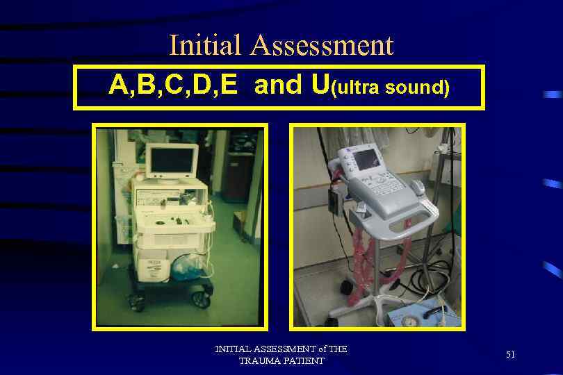 Initial Assessment A, B, C, D, E and U(ultra sound) INITIAL ASSESSMENT of THE