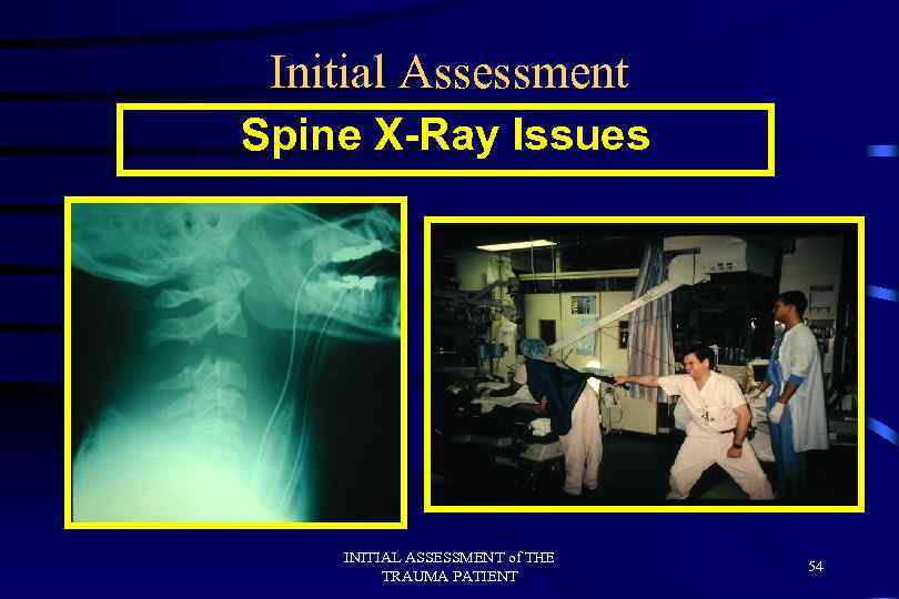 Initial Assessment Spine X-Ray Issues INITIAL ASSESSMENT of THE TRAUMA PATIENT 54 