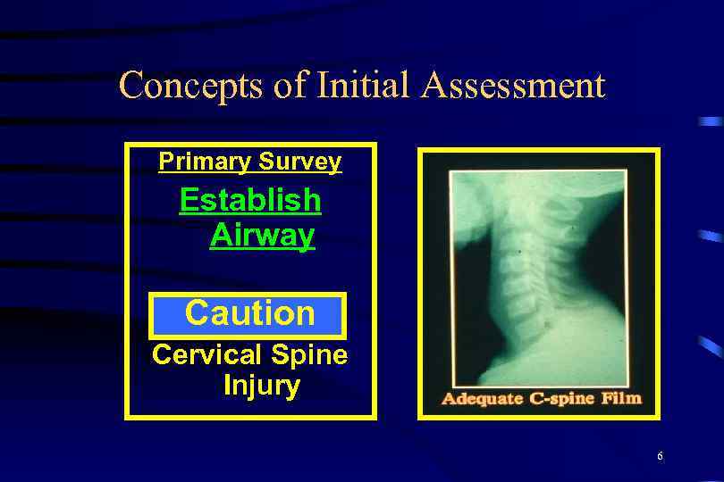 Concepts of Initial Assessment Primary Survey Establish Airway Caution Cervical Spine Injury 6 
