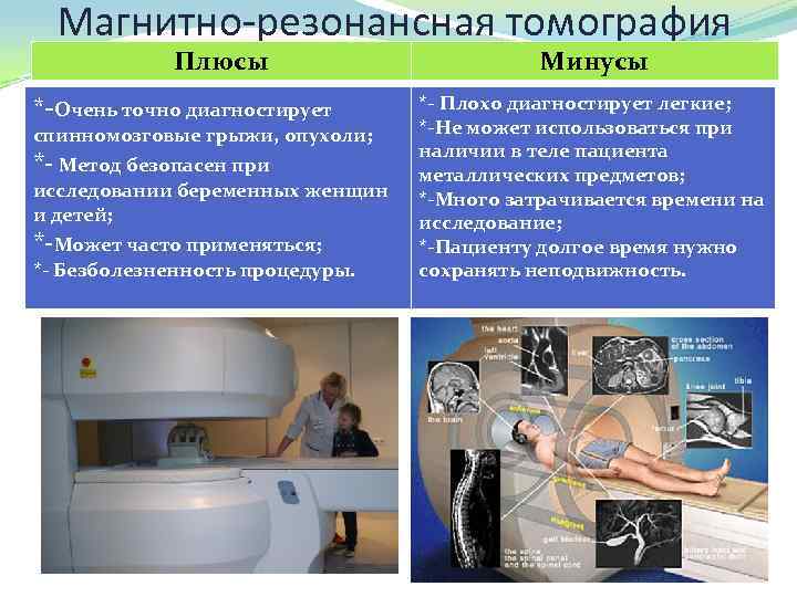 Магнитно-резонансная томография Плюсы *-Очень точно диагностирует спинномозговые грыжи, опухоли; *- Метод безопасен при исследовании