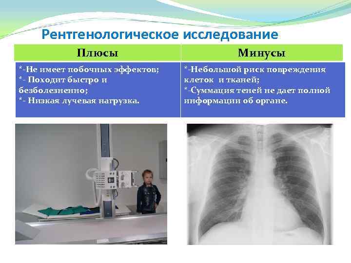 Рентгенологическое исследование Плюсы *-Не имеет побочных эффектов; *- Походит быстро и безболезненно; *- Низкая