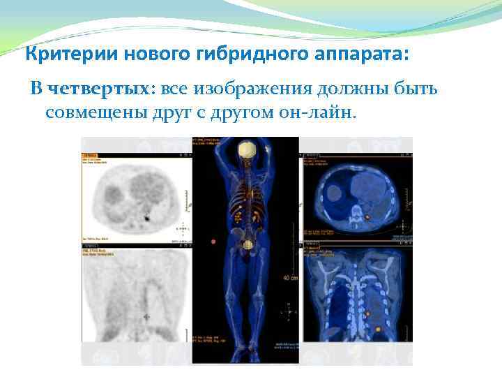 Критерии нового гибридного аппарата: В четвертых: все изображения должны быть совмещены друг с другом