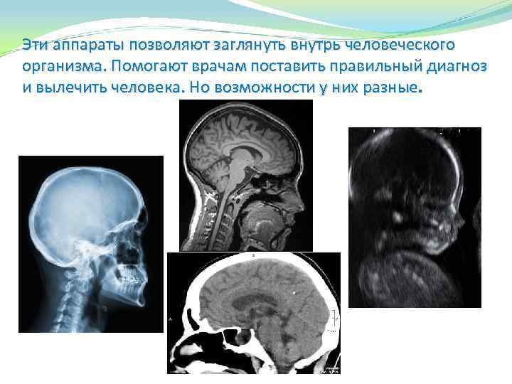 Эти аппараты позволяют заглянуть внутрь человеческого организма. Помогают врачам поставить правильный диагноз и вылечить